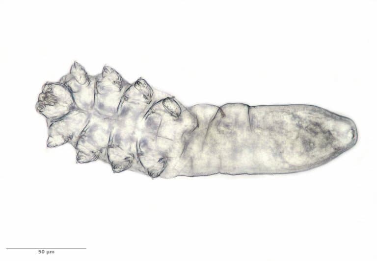 Demodex brevis, worlds smallest mite!